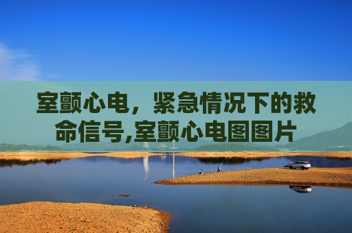 室颤心电，紧急情况下的救命信号,室颤心电图图片