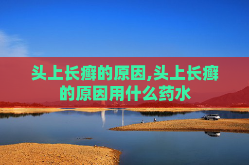 头上长癣的原因,头上长癣的原因用什么药水
