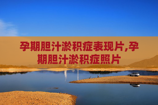 孕期胆汁淤积症表现片,孕期胆汁淤积症照片