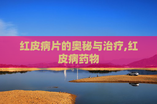 红皮病片的奥秘与治疗,红皮病药物