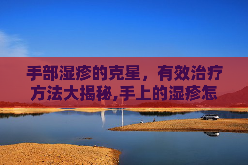 手部湿疹的克星，有效治疗方法大揭秘,手上的湿疹怎么治才根除