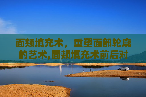 面颊填充术，重塑面部轮廓的艺术,面颊填充术前后对比