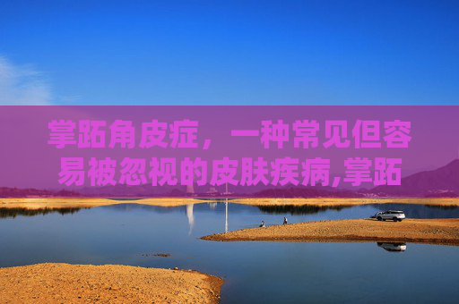 掌跖角皮症，一种常见但容易被忽视的皮肤疾病,掌跖角皮症治疗方法