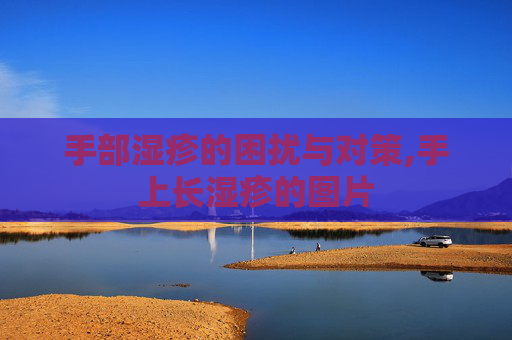 手部湿疹的困扰与对策,手上长湿疹的图片