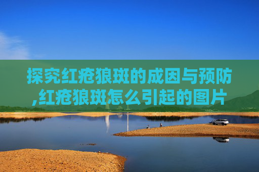 探究红疮狼斑的成因与预防,红疮狼斑怎么引起的图片