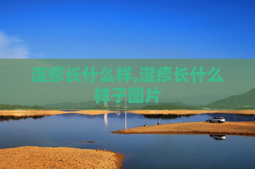 湿疹长什么样,湿疹长什么样子图片