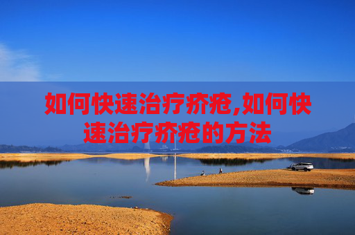 如何快速治疗疥疮,如何快速治疗疥疮的方法 如何快速治疗疥疮,如何快速治疗疥疮的方法
