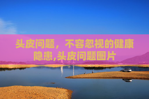 头皮问题,不容忽视的健康隐患,头皮问题图片 头皮问题,不容忽视的健康隐患,头皮问题图片