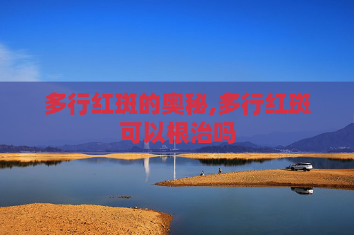 多行红斑的奥秘,多行红斑可以根治吗 多行红斑的奥秘,多行红斑可以根治吗
