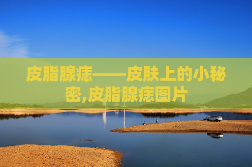 皮脂腺痣——皮肤上的小秘密,皮脂腺痣图片