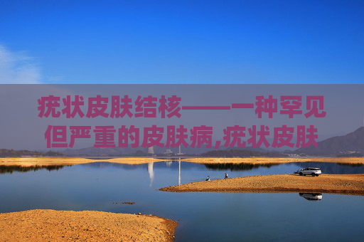 疣状皮肤结核——一种罕见但严重的皮肤病,疣状皮肤结核三廓征