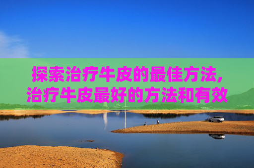 探索治疗牛皮的最佳方法,治疗牛皮最好的方法和有效的药