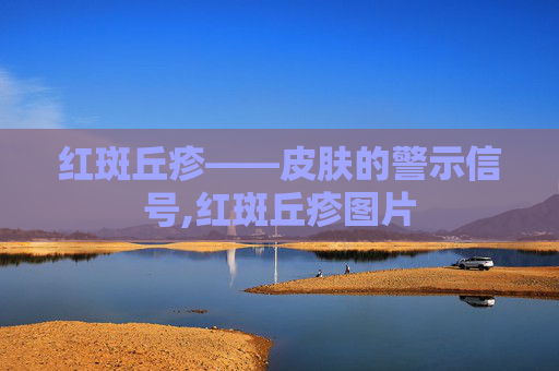 红斑丘疹——皮肤的警示信号,红斑丘疹图片