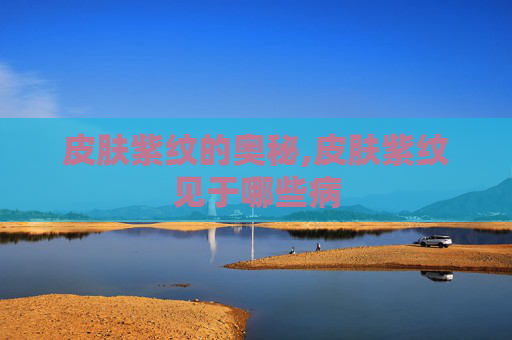 皮肤紫纹的奥秘,皮肤紫纹见于哪些病