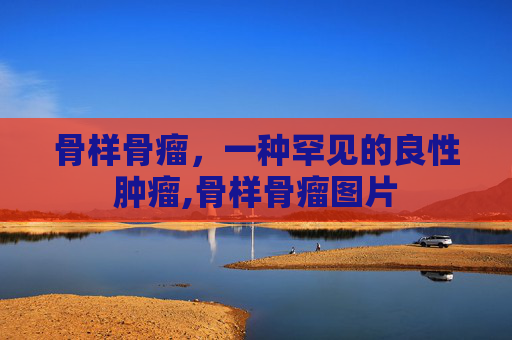 骨样骨瘤，一种罕见的良性肿瘤,骨样骨瘤图片