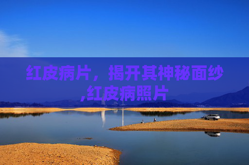 红皮病片，揭开其神秘面纱,红皮病照片