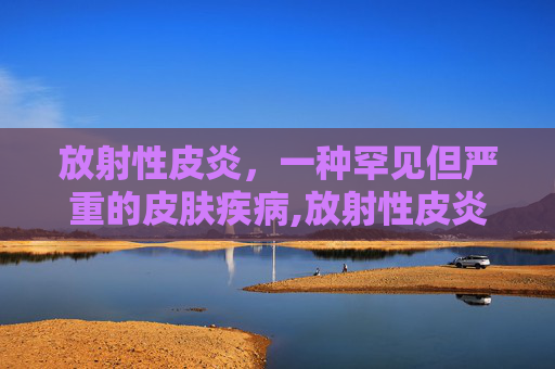 放射性皮炎，一种罕见但严重的皮肤疾病,放射性皮炎用什么药治疗效果好