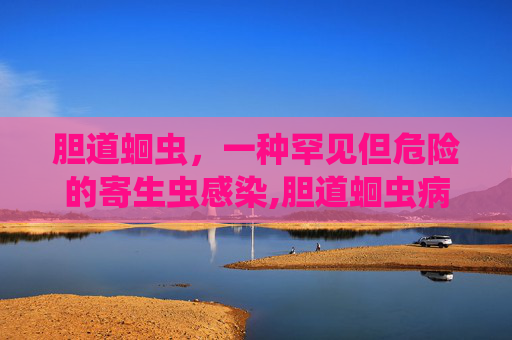 胆道蛔虫，一种罕见但危险的寄生虫感染,胆道蛔虫病腹痛的特点