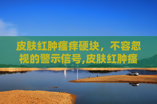 皮肤红肿瘙痒硬块，不容忽视的警示信号,皮肤红肿瘙痒硬块用什么药