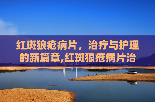 红斑狼疮病片，治疗与护理的新篇章,红斑狼疮病片治疗方法