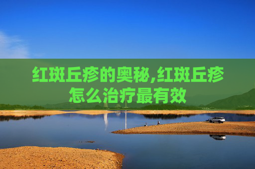 红斑丘疹的奥秘,红斑丘疹怎么治疗最有效