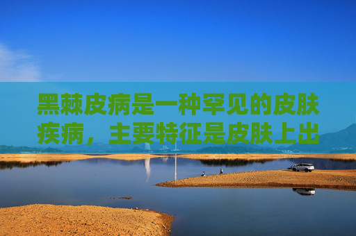 黑棘皮病是一种罕见的皮肤疾病，主要特征是皮肤上出现黑色或深棕色的斑块。这种病症通常与内分泌紊乱有关，因此治疗需要综合考虑患者的内分泌状况。以下是关于黑棘皮病的治疗建议，,肥胖引起的黑棘皮病怎么治疗